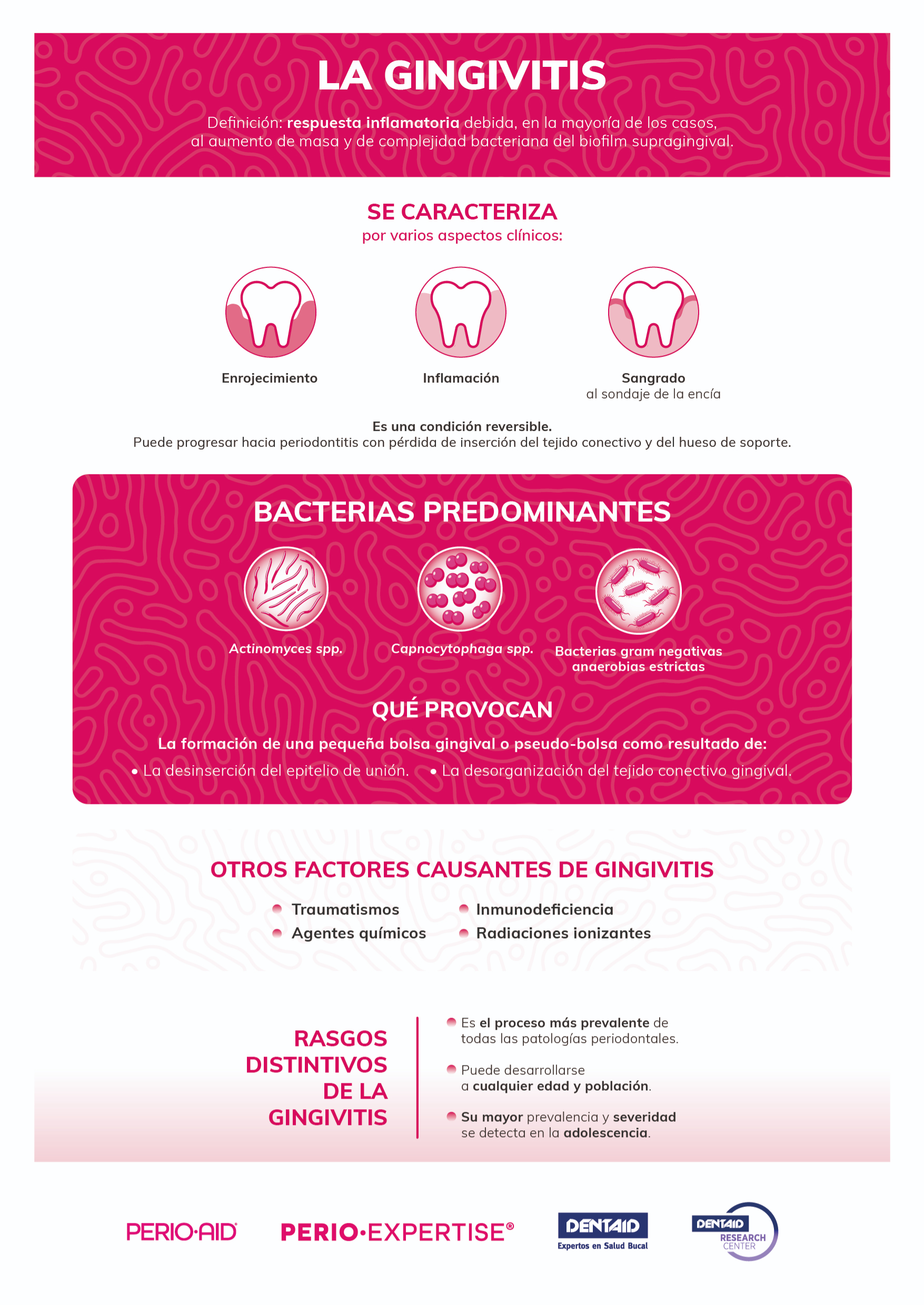La gingivitis